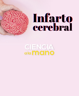 Infarto cerebral - Stroke